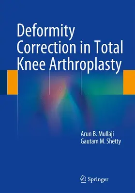 Mullaji / Shetty | Deformity Correction in Total Knee Arthroplasty | Buch | 978-1-4939-0565-2 | www.sack.de