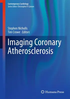 Crowe / Nicholls |  Imaging Coronary Atherosclerosis | Buch |  Sack Fachmedien