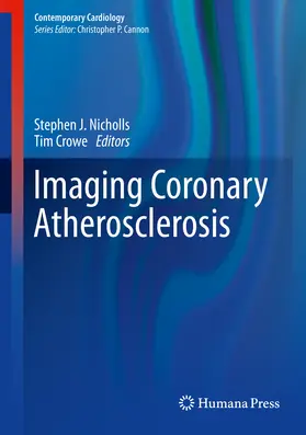 Nicholls / Crowe |  Imaging Coronary Atherosclerosis | eBook | Sack Fachmedien