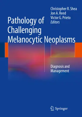 Shea / Reed / Prieto |  Pathology of Challenging Melanocytic Neoplasms | eBook | Sack Fachmedien