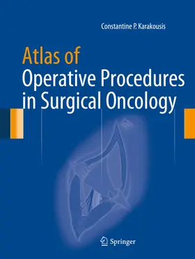 Karakousis | Atlas of Operative Procedures in Surgical Oncology | E-Book | www.sack.de