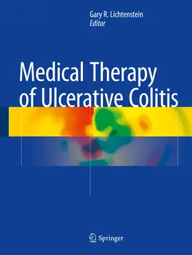 Lichtenstein |  Medical Therapy of Ulcerative Colitis | eBook | Sack Fachmedien