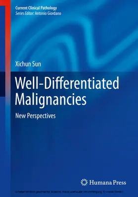 Sun | Well-Differentiated Malignancies | E-Book | www.sack.de
