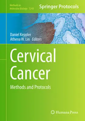 Keppler / Lin |  Cervical Cancer | eBook | Sack Fachmedien