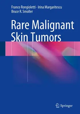 Rongioletti / Margaritescu / Smoller |  Rare Malignant Skin Tumors | Buch |  Sack Fachmedien