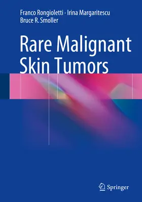 Rongioletti / Margaritescu / Smoller |  Rare Malignant Skin Tumors | eBook | Sack Fachmedien