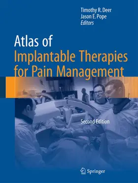 Pope / Deer |  Atlas of Implantable Therapies for Pain Management | Buch |  Sack Fachmedien