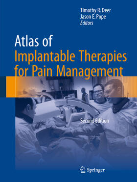 Deer / Pope | Atlas of Implantable Therapies for Pain Management | E-Book | sack.de