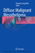 Allen |  Diffuse Malignant Mesothelioma | eBook | Sack Fachmedien