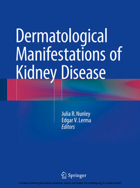 Nunley / Lerma | Dermatological Manifestations of Kidney Disease | E-Book | sack.de