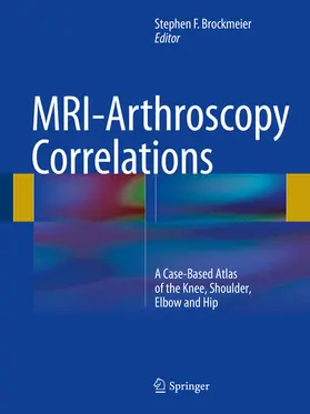 Brockmeier |  MRI-Arthroscopy Correlations | eBook | Sack Fachmedien