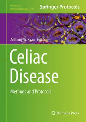 Ryan | Celiac Disease | E-Book | www.sack.de