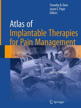 Pope / Deer | Atlas of Implantable Therapies for Pain Management | Buch | 978-1-4939-3949-7 | sack.de