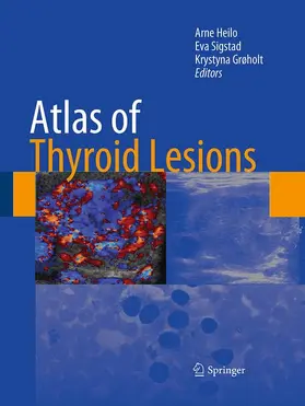 Heilo / Grøholt / Sigstad | Atlas of Thyroid Lesions | Buch | 978-1-4939-4081-3 | www.sack.de