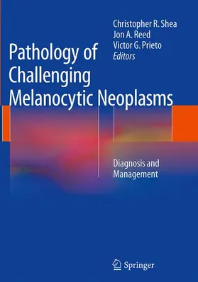 Shea / Reed / Prieto |  Pathology of Challenging Melanocytic Neoplasms | Buch |  Sack Fachmedien