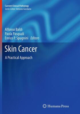 Baldi / Spugnini / Pasquali | Skin Cancer | Buch | 978-1-4939-4205-3 | sack.de