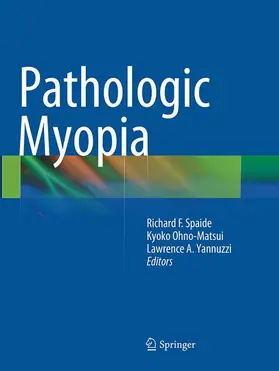 Spaide / Yannuzzi / Ohno-Matsui |  Pathologic Myopia | Buch |  Sack Fachmedien