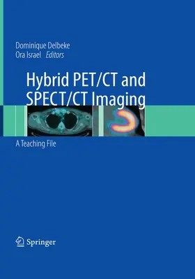 Delbeke / Israel |  Hybrid PET/CT and SPECT/CT Imaging | Buch |  Sack Fachmedien