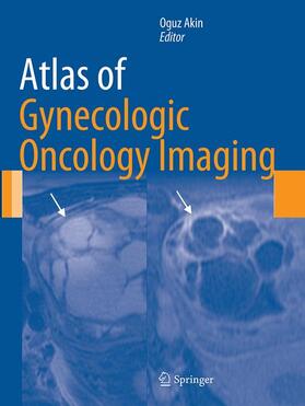 Akin | Atlas of Gynecologic Oncology Imaging | Buch | 978-1-4939-5157-4 | sack.de