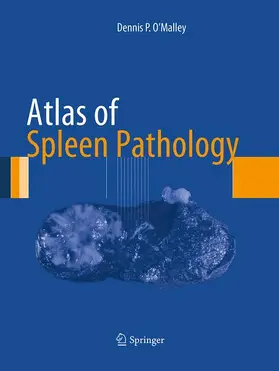 O'Malley |  Atlas of Spleen Pathology | Buch |  Sack Fachmedien