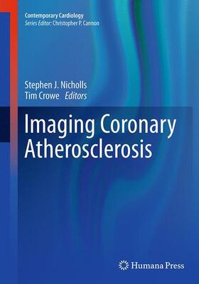 Crowe / Nicholls | Imaging Coronary Atherosclerosis | Buch | 978-1-4939-5234-2 | sack.de