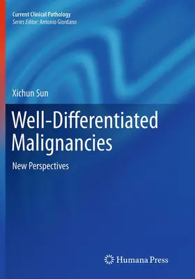 Sun | Well-Differentiated Malignancies | Buch | 978-1-4939-5267-0 | www.sack.de