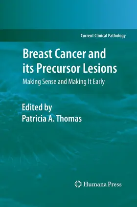 Thomas |  Breast Cancer and its Precursor Lesions | Buch |  Sack Fachmedien