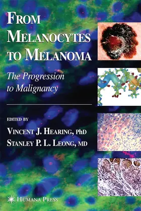 Hearing / Leong | From Melanocytes to Melanoma | Buch | 978-1-4939-5674-6 | www.sack.de