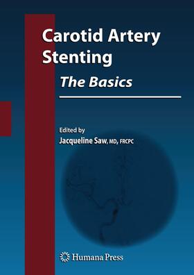 Saw |  Carotid Artery Stenting: The Basics | Buch |  Sack Fachmedien
