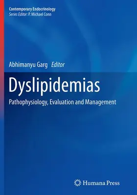 Garg | Dyslipidemias | Buch | 978-1-4939-5852-8 | www.sack.de