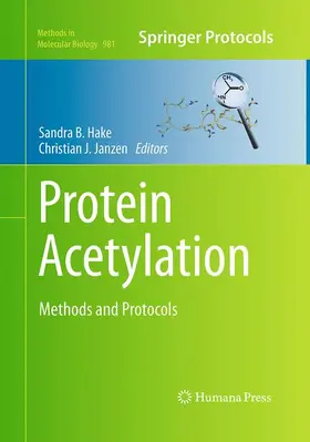 Janzen / Hake |  Protein Acetylation | Buch |  Sack Fachmedien
