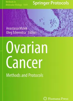 Tchernitsa / Malek |  Ovarian Cancer | Buch |  Sack Fachmedien