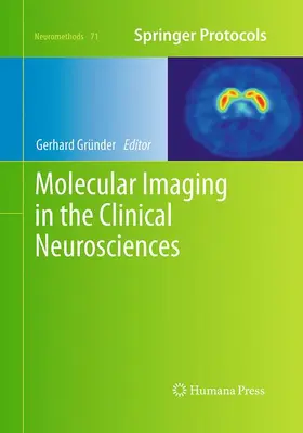 Gründer |  Molecular Imaging in the Clinical Neurosciences | Buch |  Sack Fachmedien