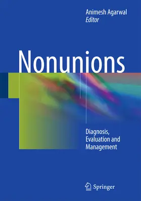 Agarwal | Nonunions | E-Book | sack.de