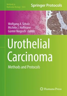 Schulz / Niegisch / Hoffmann |  Urothelial Carcinoma | Buch |  Sack Fachmedien