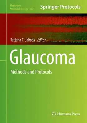 Jakobs |  Glaucoma | Buch |  Sack Fachmedien
