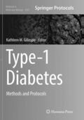 Gillespie |  Type-1 Diabetes | Buch |  Sack Fachmedien