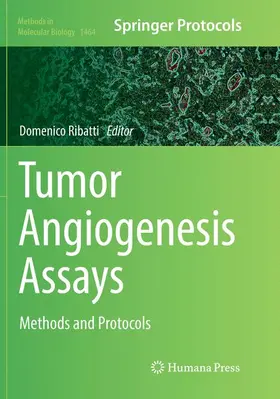 Ribatti |  Tumor Angiogenesis Assays | Buch |  Sack Fachmedien