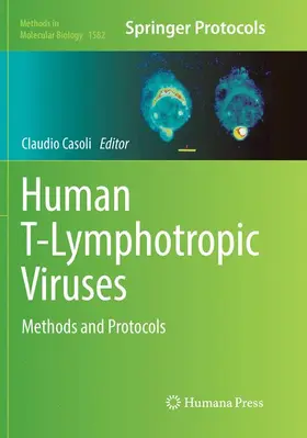 Casoli | Human T-Lymphotropic Viruses | Buch | 978-1-4939-8324-7 | www.sack.de