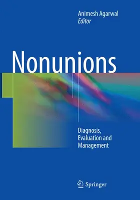 Agarwal |  Nonunions | Buch |  Sack Fachmedien