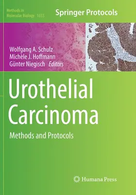 Schulz / Niegisch / Hoffmann |  Urothelial Carcinoma | Buch |  Sack Fachmedien