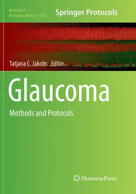 Jakobs | Glaucoma | Buch | 978-1-4939-8476-3 | www.sack.de