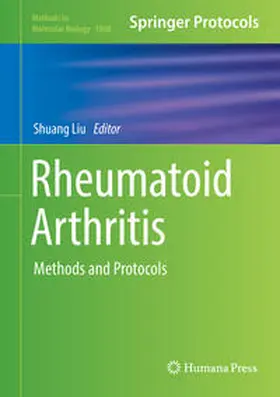 Liu | Rheumatoid Arthritis | E-Book | www.sack.de