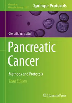 Su |  Pancreatic Cancer | eBook | Sack Fachmedien