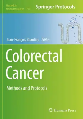 Beaulieu |  Colorectal Cancer | Buch |  Sack Fachmedien