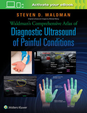 Waldman | Waldman's Comprehensive Atlas of Diagnostic Ultrasound of Painful Conditions | Buch | 978-1-4963-0289-2 | sack.de