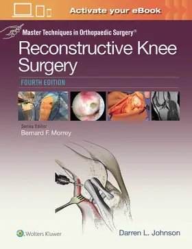 Johnson |  Master Techniques in Orthopaedic Surgery | Buch |  Sack Fachmedien