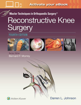 Johnson | Master Techniques in Orthopaedic Surgery: Reconstructive Kne | Buch | 978-1-4963-1827-5 | sack.de