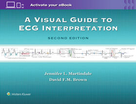 Martindale / Brown | Martindale, J: A Visual Guide to ECG Interpretation | Buch | 978-1-4963-2153-4 | sack.de