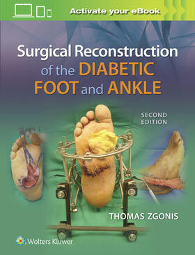 Zgonis | Surgical Reconstruction of the Diabetic Foot and Ankle | Buch | 978-1-4963-3007-9 | sack.de